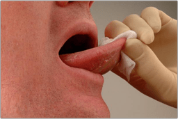 mouth-cancer-soft-tissue-exam